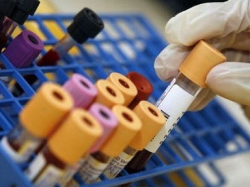 Tre morti per legionella in Lombardia: il batterio non è nell’acquedotto