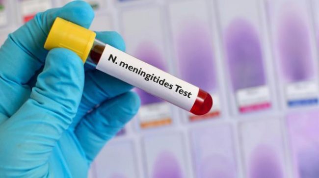 Nuovo caso di meningite in Lombardia