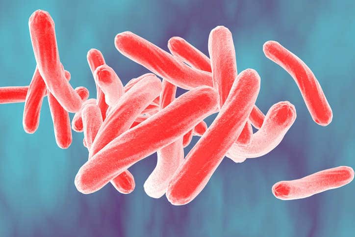 Caso di tubercolosi a scuola in Lombardia. Altro studente morto in Piemonte
