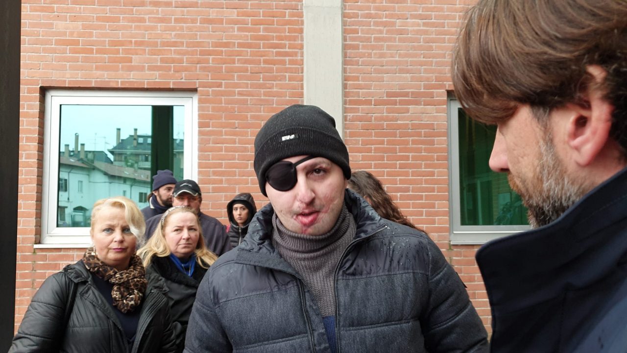 Aggredisci l’ex con l’acido a Legnano, respinto il patteggiamento