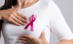 Lotta al tumore al seno, la riforma regionale dei Centri di Senologia nasce da Varese