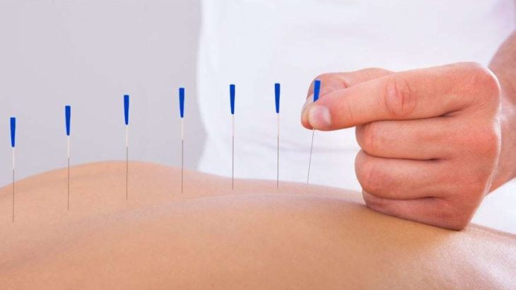 L’Agopuntura approda all’Ospedale di Tradate: tra Tradizione Orientale e Innovazione Clinica