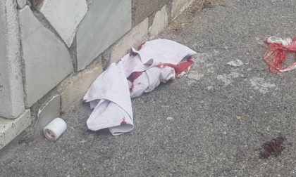 Sangue a Legnano: anziano esce di casa e si accoltella in strada