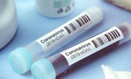 Coronavirus in Lombardia: 3.116 casi