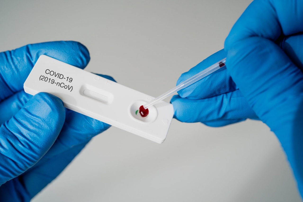 Tamponi rapidi in Ats e Asst, presto anche da medici di famiglia, pediatri e nel privato