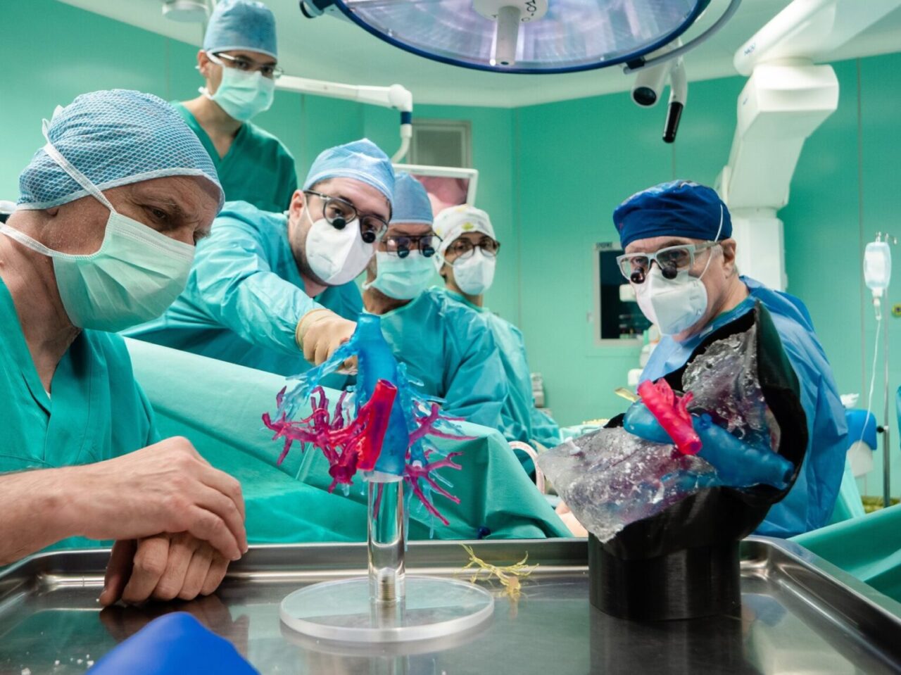 Un figlio dona al padre metà fegato, trapianto effettuato con la stampa 3D dell’organo