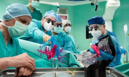 Un figlio dona al padre metà fegato, trapianto effettuato con la stampa 3D dell'organo