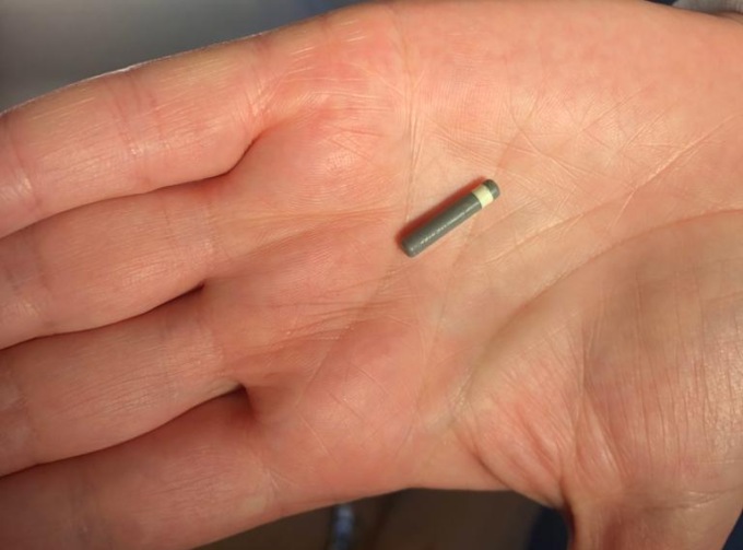 Un chip sotto la pelle per monitorare il diabete: il primo a Cittiglio