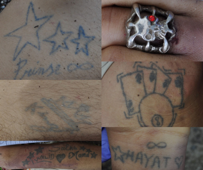 Chi è il giovane senza vita trovato lungo la 336? La Questura diffonde i suoi tatuaggi