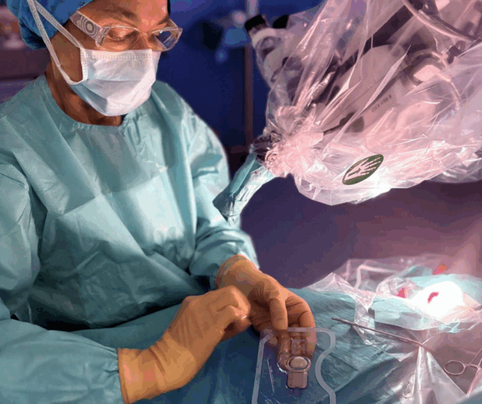 impianto cocleare asst sette laghi